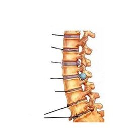 etapas de desenvolvemento da osteocondrose