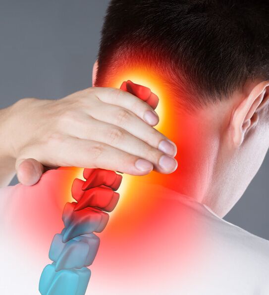 Síntomas da osteocondrose cervical
