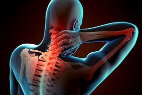 Osteocondrose cervical
