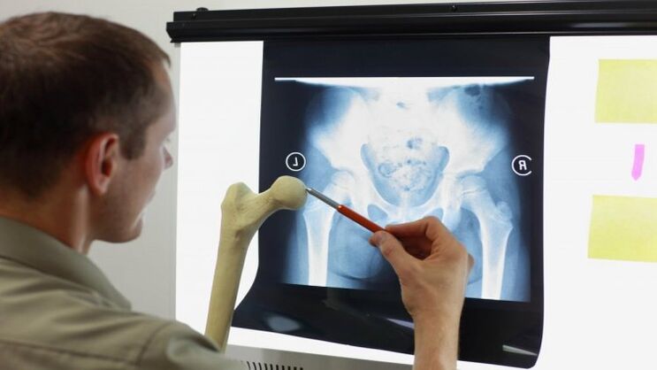 O doutor examina unha radiografía para detectar a artrose da cadeira