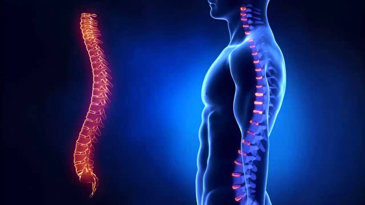 A osteocondrose clasifícase segundo as partes da columna nas que se desenvolve a enfermidade.
